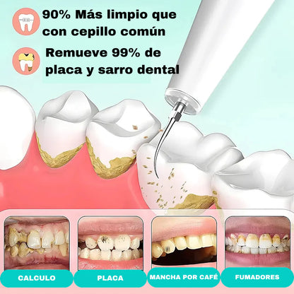 CEPIFY® | Removedor de Sarro Magnético